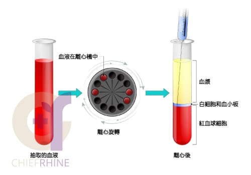 自體脂肪純化萃取示意圖